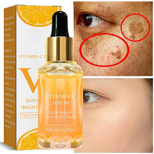 Vitamin C Whitening Serum